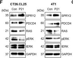 Fig.1.F showing Western Blotting from the publication: Targeted delivery of anti-miRNA21 sensitizes PD-L1high tumor to immunotherapy by promoting immunogenic cell death.