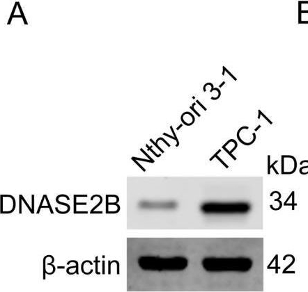 Fig.9.A showing Western Blotting in a Homo sapiens (Human) sample from the publication: Multi-omics analysis and single-cell sequencing revealed the lysosome associated molecular subtypes and prognostic model development of papillary thyroid carcinoma.