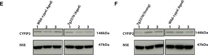 Fig.1.E,F showing Western Blotting in a Mus musculus (House mouse) sample from the publication: Alzheimer-related decrease in CYFIP2 links amyloid production to tau hyperphosphorylation and memory loss.