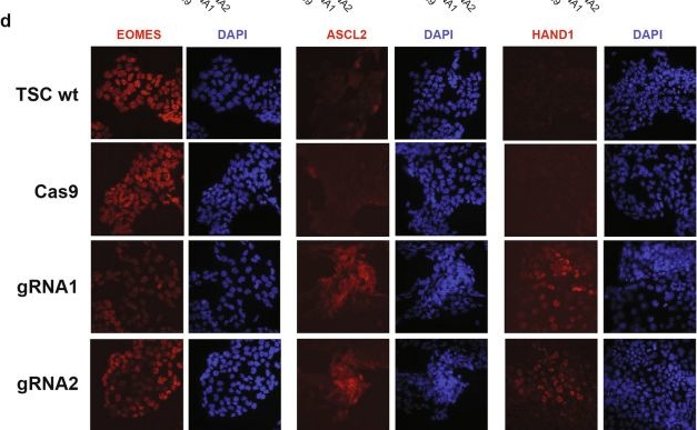 Fig.2.D showing Immunocytochemistry-immunofluorescence from the publication: Histone demethylase JMJD2B/KDM4B regulates transcriptional program via distinctive epigenetic targets and protein interactors for the maintenance of trophoblast stem cells.