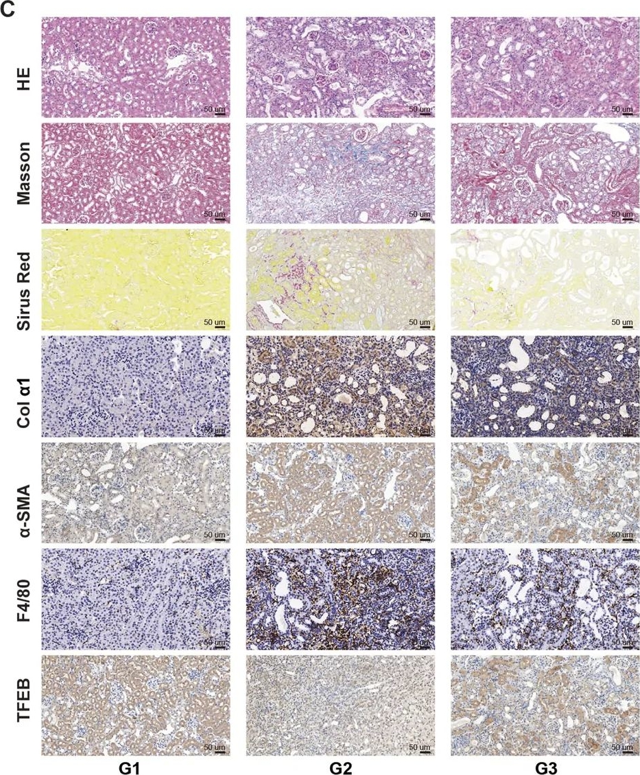 Fig.7.C showing Immunohistochemistry from the publication: Genkwanin mitigates renal fibrosis by reprogramming profibrotic signaling and restoring TFEB-mediated autophagy.