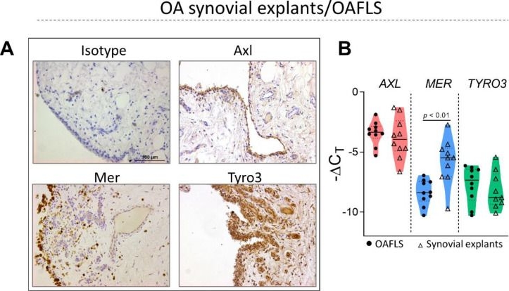 Fig.1.A showing Immunohistochemistry in a Homo sapiens (Human) sample from the publication: Gas6/Axl Axis Activation Dampens the Inflammatory Response in Osteoarthritic Fibroblast-like Synoviocytes and Synovial Explants.