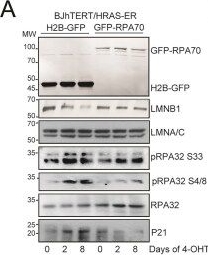 Fig.7.A showing Western Blotting in a Homo sapiens (Human) sample from the publication: RPA hyperphosphorylation hinders the resolution of R-loops and G-quadruplex-associated R-loops during RAS-driven senescence.