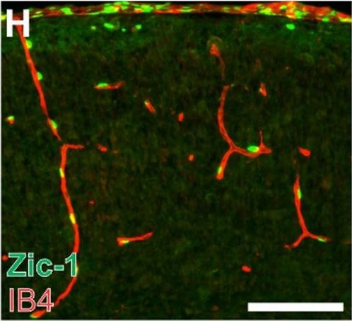 Fig.4.H showing Immunohistochemistry-immunofluorescence in a Mus musculus (House mouse) sample from the publication: Foxc1 is required by pericytes during fetal brain angiogenesis.