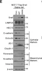 Fig.4.E showing Western Blotting from the publication: Chaperone-mediated autophagy modulates Snail protein stability: implications for breast cancer metastasis.