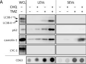 Fig.3.A showing Western Blotting in a Homo sapiens (Human) sample from the publication: Synergistic Upregulation of Extracellular Vesicles and Cell-Free Nucleic Acids by Chloroquine and Temozolomide in Glioma Cell Cultures.