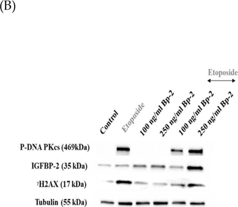 Igfbp2 antibodies - Antibody search engine - CiteAb