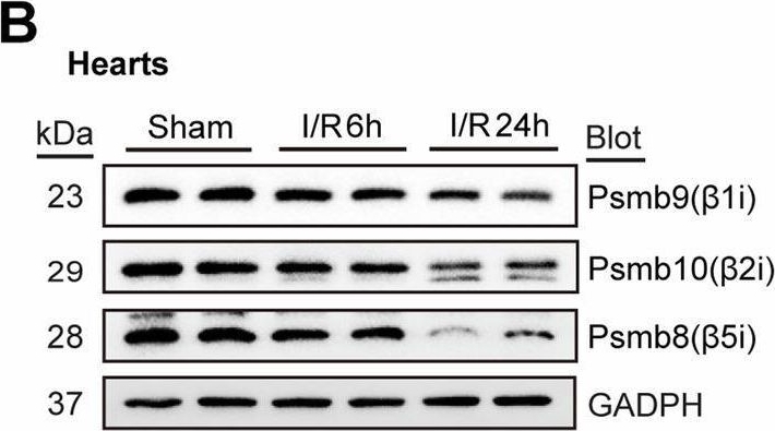 Fig.1.B showing Western Blotting from the publication: Psmb8 inhibits mitochondrial fission and alleviates myocardial ischaemia/reperfusion injury by targeting Drp1 degradation.