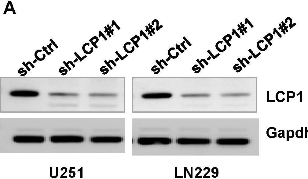 Fig.8.A showing Western Blotting in a Homo sapiens (Human) sample from the publication: Lactylation-related gene signatures identify glioma molecular subtypes with prognostic, immunological, and therapeutic implications.