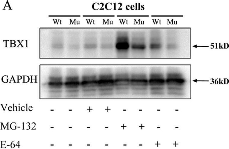 Fig.5.A showing Western Blotting from the publication: A 3 base pair deletion in TBX1 leads to reduced protein expression and transcriptional activity.