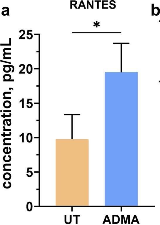 Fig.3.A showing Enzyme-linked immunosorbent assay in a Homo sapiens (Human) sample from the publication: Asymmetric dimethylarginine induces maladaptive function of the blood-brain barrier.