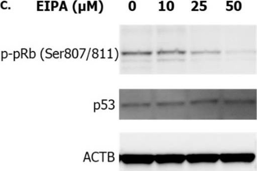 Fig.2.C showing Western Blotting in a Homo sapiens (Human) sample from the publication: P53-Independent G1-Cell Cycle Arrest Increases SARS-CoV-2 RNA Replication.