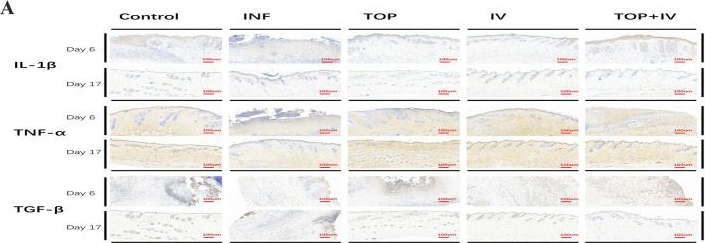 Fig.5.A showing Immunohistochemistry from the publication: Comparative study on the wound healing effects of local versus systemic application of Polymyxin B in mice infected with multidrug-resistant Pseudomonas aeruginosa.