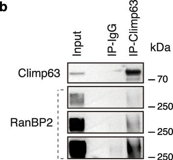 Fig.7.B showing Western Blotting in a Homo sapiens (Human) sample from the publication: RanBP2-dependent annulate lamellae drive nuclear pore assembly and nuclear expansion.