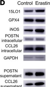 Fig.4.D showing Western Blotting from the publication: 15LO1 dictates glutathione redox changes in asthmatic airway epithelium to worsen type 2 inflammation.