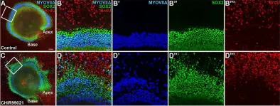 Fig.1.A showing Immunofluorescence in a Mus musculus (House mouse) sample from the publication: Transcriptional response to Wnt activation regulates the regenerative capacity of the mammalian cochlea.