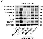 Fig.5.J showing Western Blotting from the publication: TDGF1 Mediates the Oncogenic Effects of the OLMALINC/miR-3614-5p ceRNA Axis in Colon Cancer Through Nodal/Smad2 and Glypican-1/MAPK-AKT Signaling.