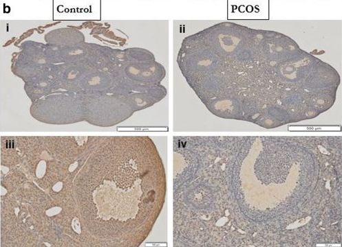 Fig.4.B showing Immunohistochemistry in a Mus musculus (House mouse) sample from the publication: Expression of the plasminogen system in the physiological mouse ovary and in the pathological polycystic ovary syndrome (PCOS) state.