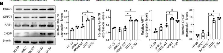 Fig.2.B showing Western Blotting in a Mus musculus (House mouse) sample from the publication: The critical role of GRP78/BiP MARylation in ER stress of KRAS-mutant colorectal cancer.