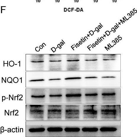 Fig.4.F showing Western Blotting from the publication: Preventive Effect of Fisetin on Follicular Granulosa Cells Senescence via Attenuating Oxidative Stress and Upregulating the Wnt/β-Catenin Signaling Pathway.