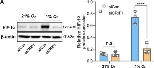 Fig.3.A showing Western Blotting from the publication: The Downregulation of CRIF1 Exerts Antitumor Effects Partially via TP53-Induced Glycolysis and Apoptosis Regulator Induction in BT549 Breast Cancer Cells.