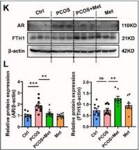 Fig.6.K showing Western Blotting from the publication: Hyperandrogenemia Induces Trophoblast Ferroptosis and Early Pregnancy Loss in Patients With PCOS via CMA-Dependent FTH1 Degradation.