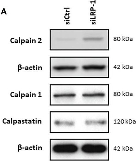 Fig.4.A showing Western Blotting in a Homo sapiens (Human) sample from the publication: LRP-1-dependent control of calpain expression and activity: A new mechanism regulating thyroid carcinoma cell adhesion.
