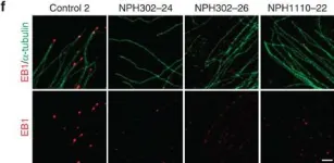 Fig.5.F showing Western Blotting in a Homo sapiens (Human) sample from the publication: Mutations in TRAF3IP1/IFT54 reveal a new role for IFT proteins in microtubule stabilization.