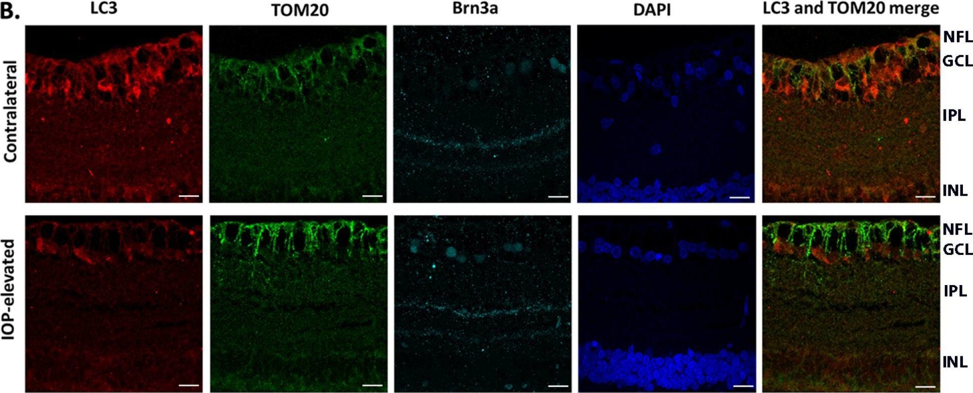 Fig.5.B showing Immunohistochemistry-immunofluorescence in a Rattus norvegicus (Rat) sample from the publication: A Reduction in Mitophagy Is Associated with Glaucomatous Neurodegeneration in Rodent Models of Glaucoma.
