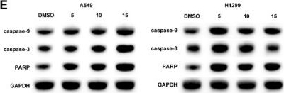 Fig.1.E showing Western Blotting in a Homo sapiens (Human) sample from the publication: Oleanolic acid-chitosan compound inhibits mitochondrial autophagy and malignant transformation of lung cancer through the PTEN/AKT pathway.