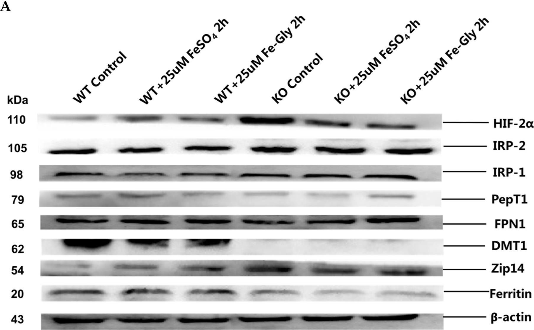 Fig.5.A showing Western Blotting from the publication: Iron Transport from Ferrous Bisglycinate and Ferrous Sulfate in DMT1-Knockout Human Intestinal Caco-2 Cells.