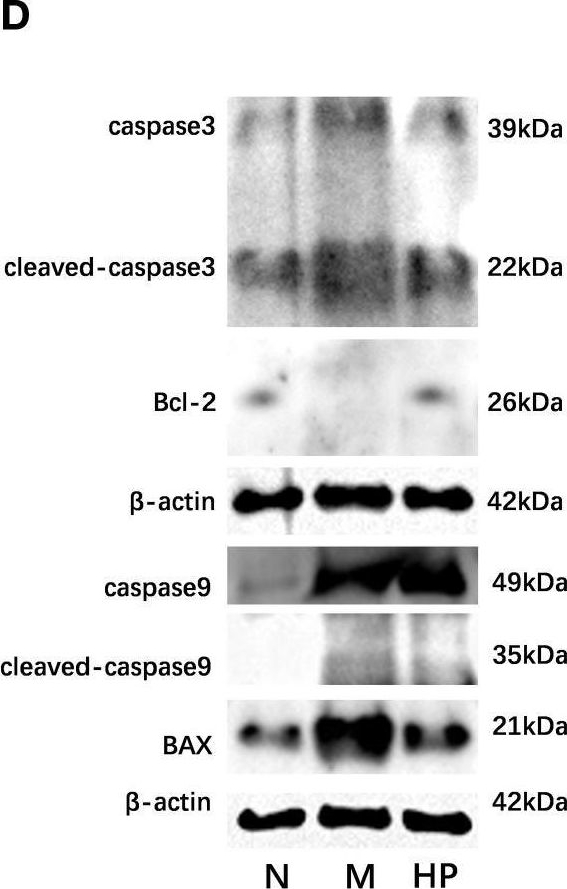 Fig.3.D showing Western Blotting from the publication: The postbiotic of hawthorn-probiotic ameliorates constipation by multi-pathway inhibition of PANoptosis in intestinal epithelial cells.