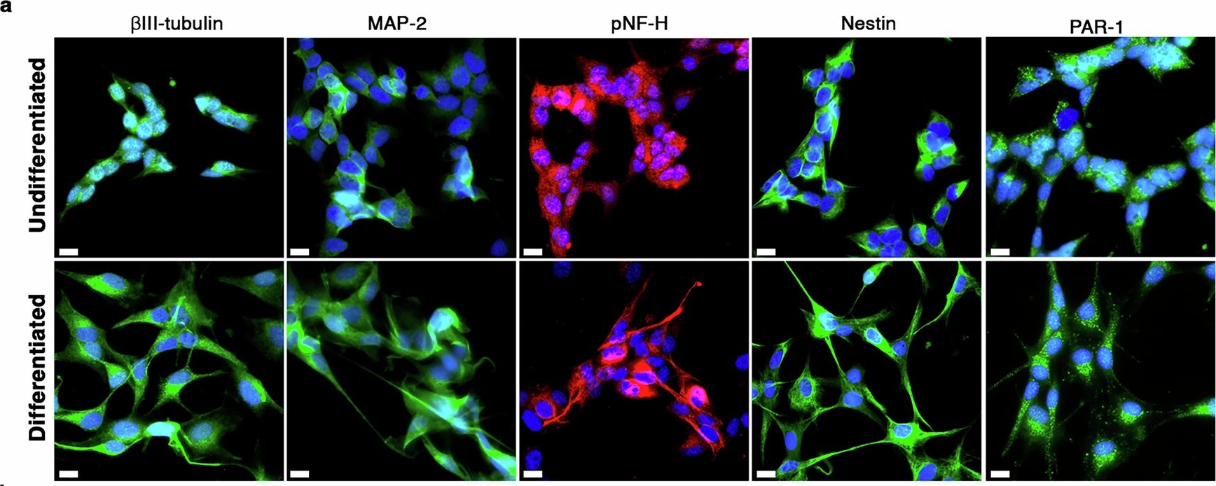 Fig.9.A showing Immunocytochemistry-immunofluorescence from the publication: CD103-CD8+ T cells promote neurotoxic inflammation in Alzheimer's disease via granzyme K-PAR-1 signaling.