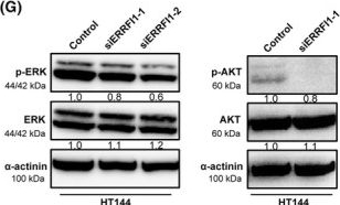 Fig.5.G showing Western Blotting in a Homo sapiens (Human) sample from the publication: The neural crest-associated gene ERRFI1 is involved in melanoma progression and resistance toward targeted therapy.