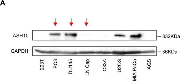 Fig.4.A showing Western Blotting from the publication: Structural insight into ASH1L PHD finger recognizing methylated histone H3K4 and promoting cell growth in prostate cancer.