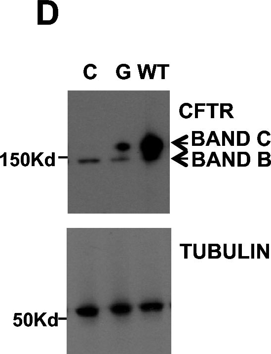 Fig.1.D showing Western Blotting in a Mesocricetus auratus (Golden Syrian hamster) sample from the publication: The NSAID glafenine rescues class 2 CFTR mutants via cyclooxygenase 2 inhibition of the arachidonic acid pathway.