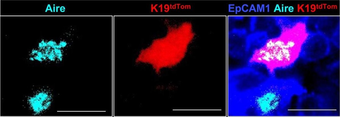 Fig.7.F showing Immunohistochemistry-immunofluorescence in a Mus musculus (House mouse) sample from the publication: Embryonic keratin19+ progenitors generate multiple functionally distinct progeny to maintain epithelial diversity in the adult thymus medulla.