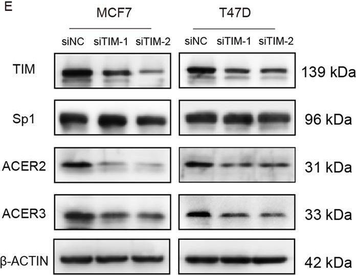 Fig.3.E showing Western Blotting in a Homo sapiens (Human) sample from the publication: TIMELESS regulates sphingolipid metabolism and tumor cell growth through Sp1/ACER2/S1P axis in ER-positive breast cancer.