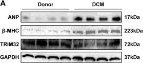 Fig.1.A showing Western Blotting in a Homo sapiens (Human) sample from the publication: Tripartite motif 32 prevents pathological cardiac hypertrophy.