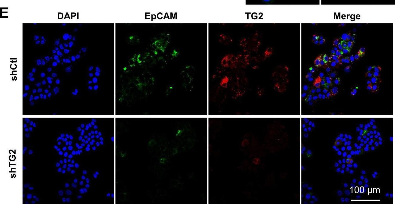 Fig.3.E showing Immunocytochemistry-immunofluorescence in a Homo sapiens (Human) sample from the publication: Targeting transglutaminase 2 mediated exostosin glycosyltransferase 1 signaling in liver cancer stem cells with acyclic retinoid.