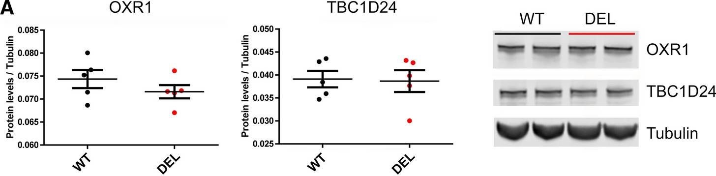 Fig.9.A showing Western Blotting in a Mus musculus (House mouse) sample from the publication: The Ncoa7 locus regulates V-ATPase formation and function, neurodevelopment and behaviour.