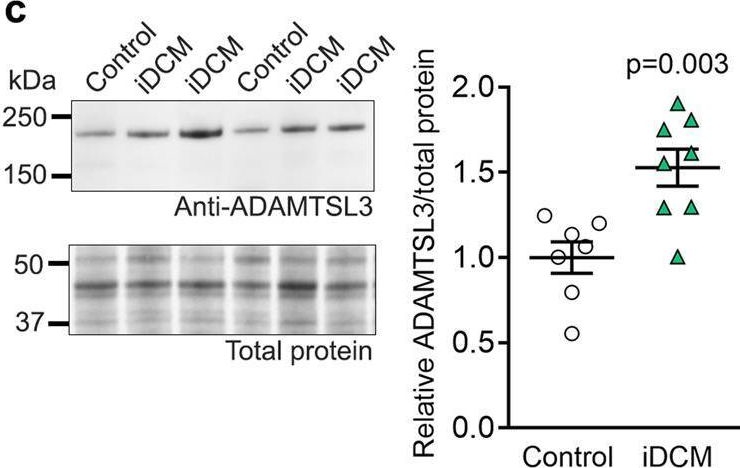 Fig.1.C showing Western Blotting from the publication: ADAMTSL3 knock-out mice develop cardiac dysfunction and dilatation with increased TGFβ signalling after pressure overload.