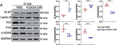p16 INK4A (E6N8P) Rabbit Monoclonal Antibody | Cell Signaling