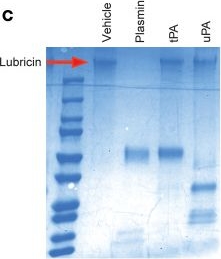 Fig.4.C showing Western Blotting from the publication: Dysregulated fibrinolysis and plasmin activation promote the pathogenesis of osteoarthritis.