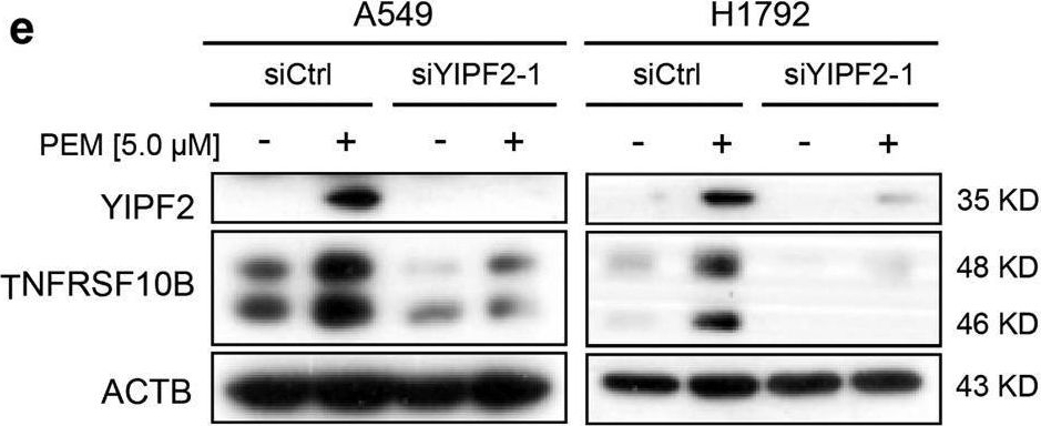 Fig.2.E showing Western Blotting in a Homo sapiens (Human) sample from the publication: YIPF2 promotes chemotherapeutic agent-mediated apoptosis via enhancing TNFRSF10B recycling to plasma membrane in non-small cell lung cancer cells.