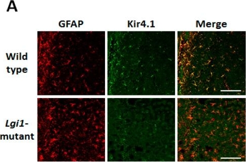 Down-Regulation of Astrocytic Kir4.1 Channels during the Audiogenic Epileptogenesis in Leucine-Rich Glioma-Inactivated 1 (Lgi1) Mutant Rats.