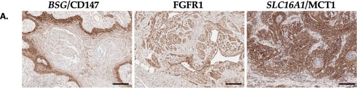 Fig.3.A showing Immunohistochemistry in a Homo sapiens (Human) sample from the publication: An Assessment of the Penile Squamous Cell Carcinoma Surfaceome for Biomarker and Therapeutic Target Discovery.