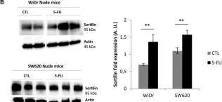 Fig.4.B showing Western Blotting from the publication: Overexpression of sortilin is associated with 5-FU resistance and poor prognosis in colorectal cancer.