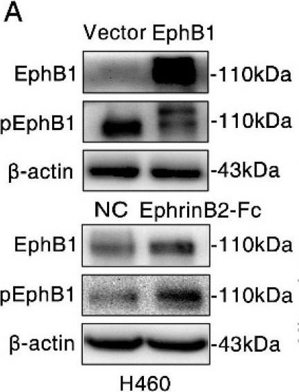 Fig.3.A showing Western Blotting in a Homo sapiens (Human) sample from the publication: Ligand-independent EphB1 signaling mediates TGF-β-activated CDH2 and promotes lung cancer cell invasion and migration.