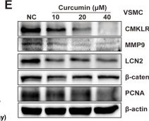 Fig.5.E showing Western Blotting in a Mus musculus (House mouse) sample from the publication: Curcumin inhibits the proliferation and migration of vascular smooth muscle cells by targeting the chemerin / CMKLR1 / LCN2 axis.